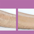 Depiladoras elétricas – depilação rápida e precisa
